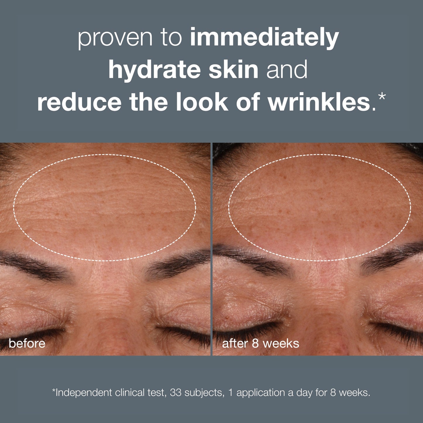 Dynamic Skin Recovery Spf50 Moisturiser