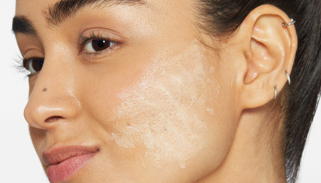 How to clear and prevent blackheads