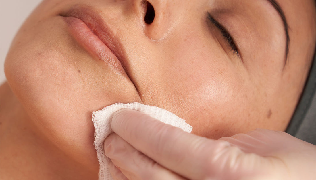 dos and don’ts for post-peel care