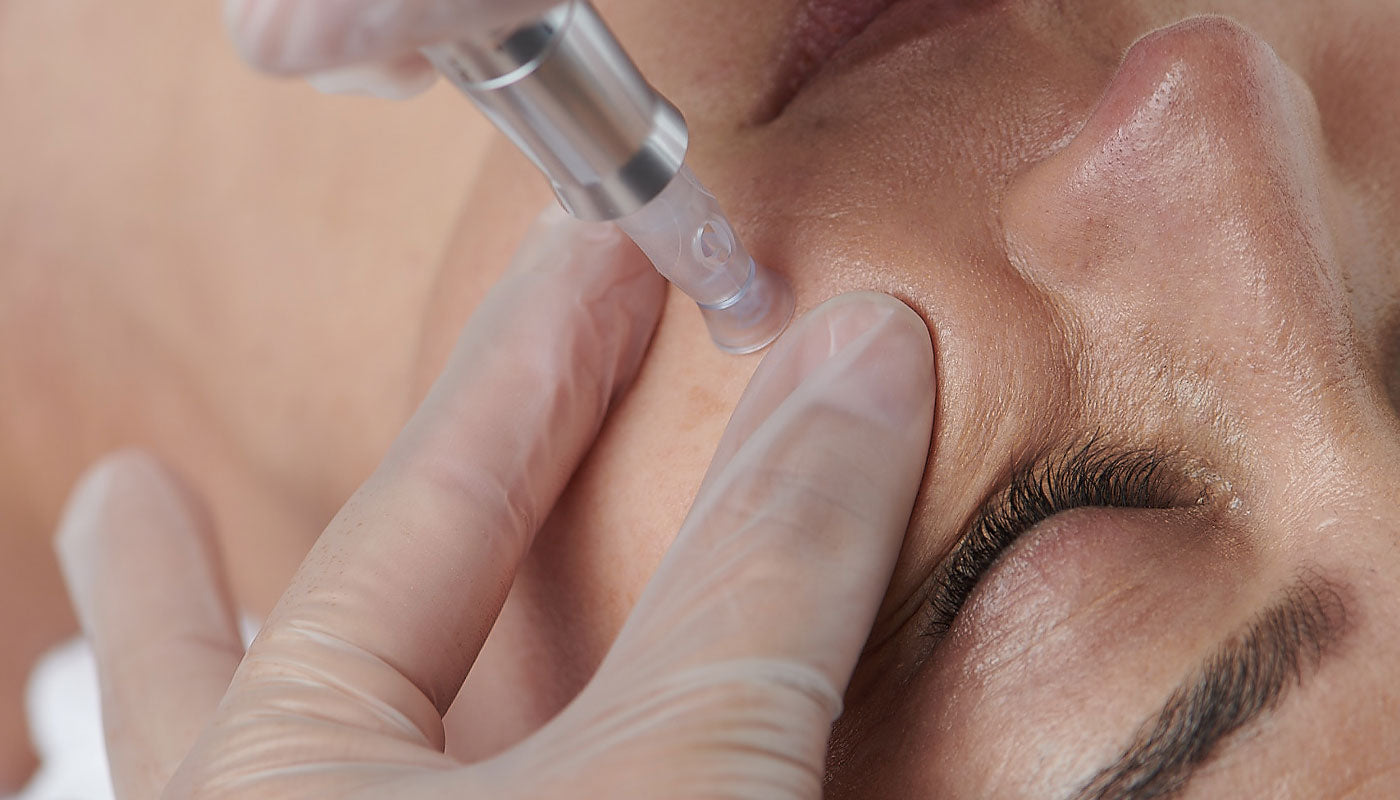 Microneedling: Everything you need to know – Dermalogica IE