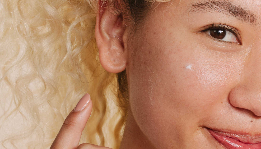 Treating Breakouts And The Marks They Leave Behind