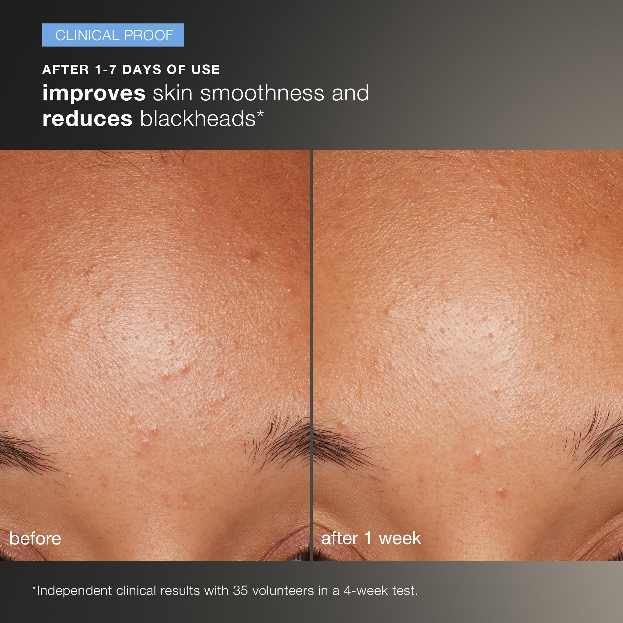 Daily Microfoliant Exfoliator