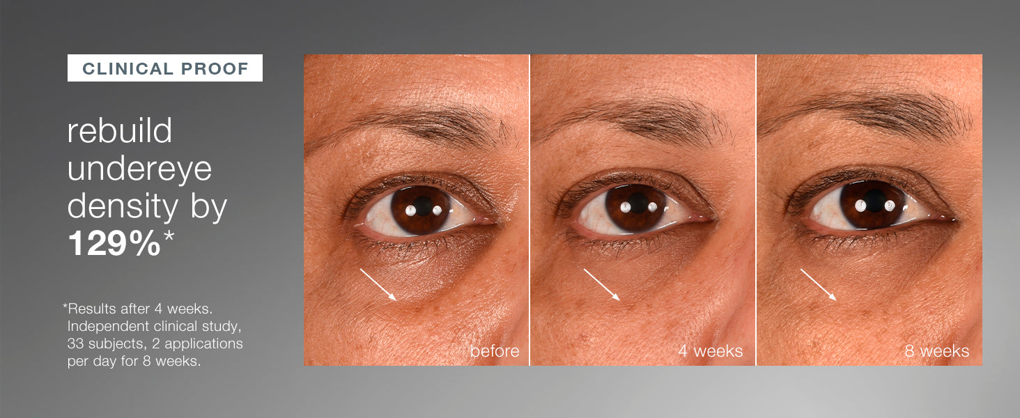 Smart Eye Density