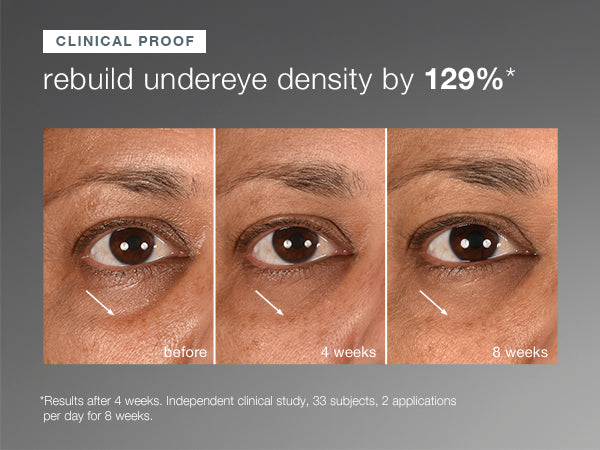Smart Eye Density