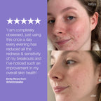 stabilizing repair trio