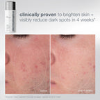 pro ritual: exfoliate + glow (1 full size + 2 skincare tools)