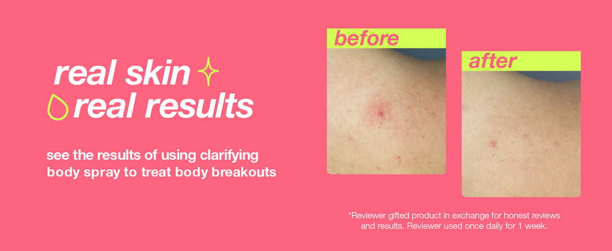 Clarifying Body Spray