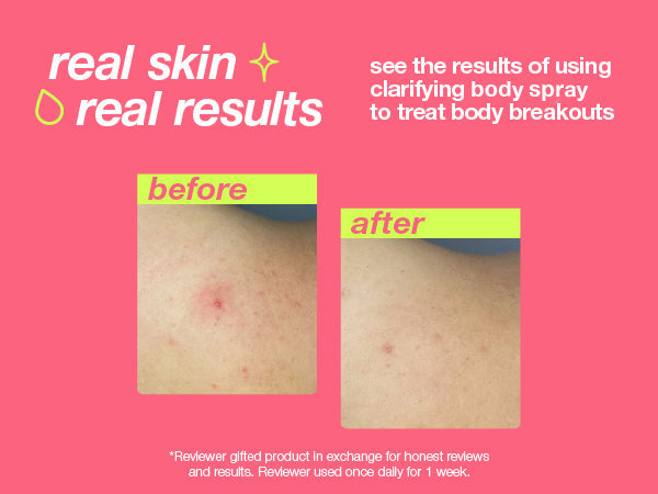 Clarifying Body Spray