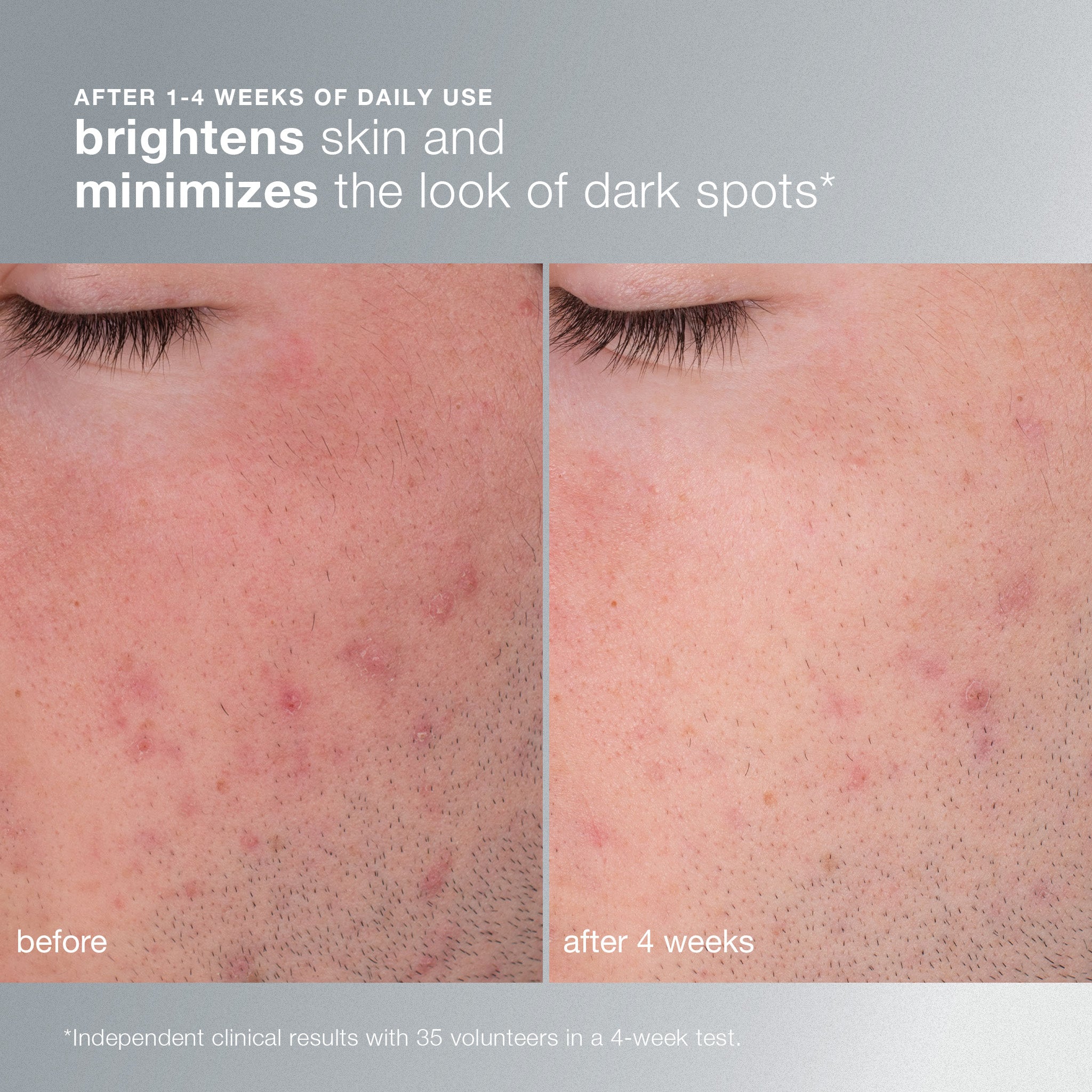 Daily Microfoliant Exfoliator