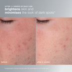 Daily Microfoliant Exfoliator