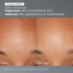 Daily Microfoliant Exfoliator