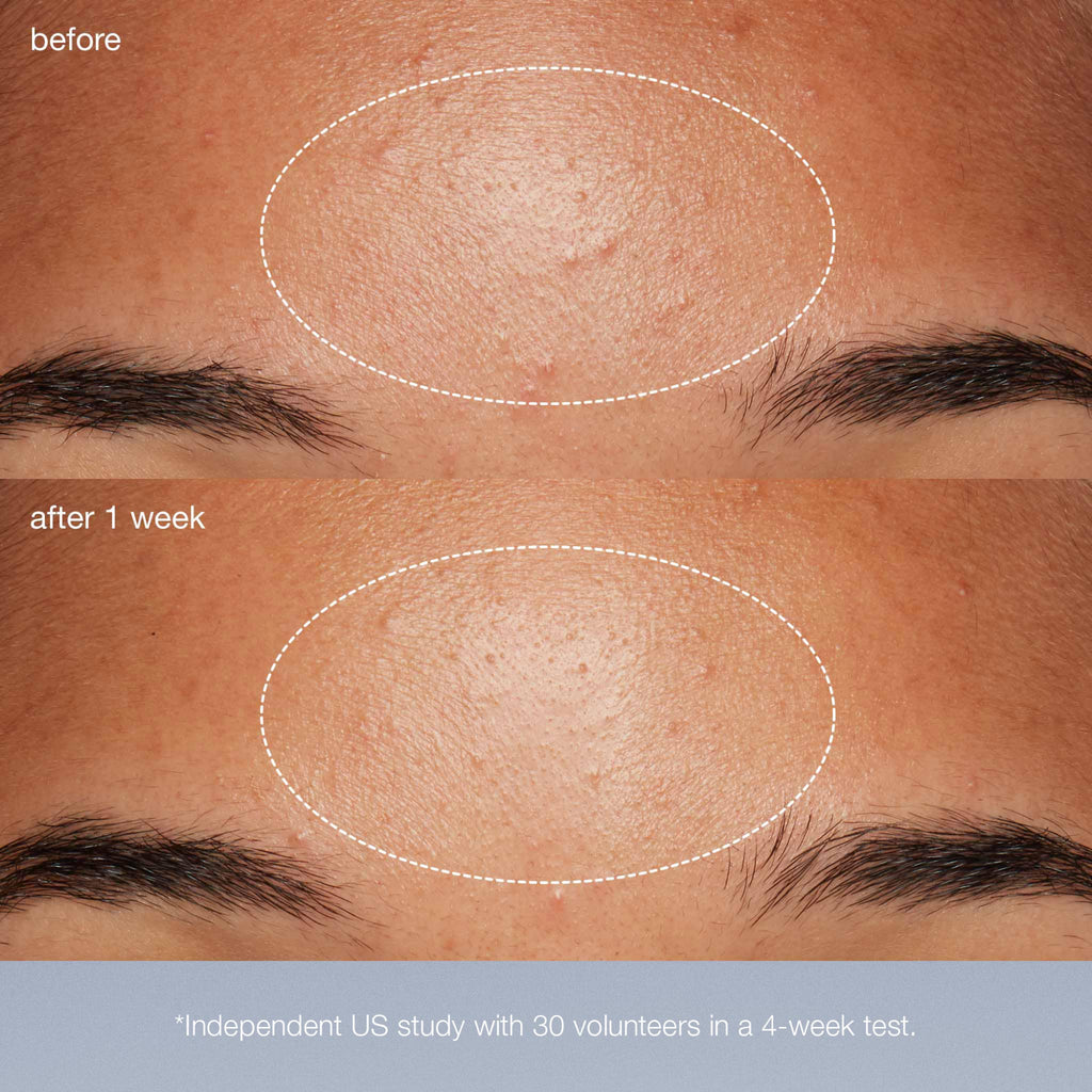 special cleansing gel + daily microfoliant exfoliator