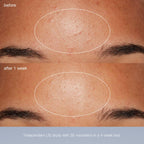 special cleansing gel + daily microfoliant exfoliator