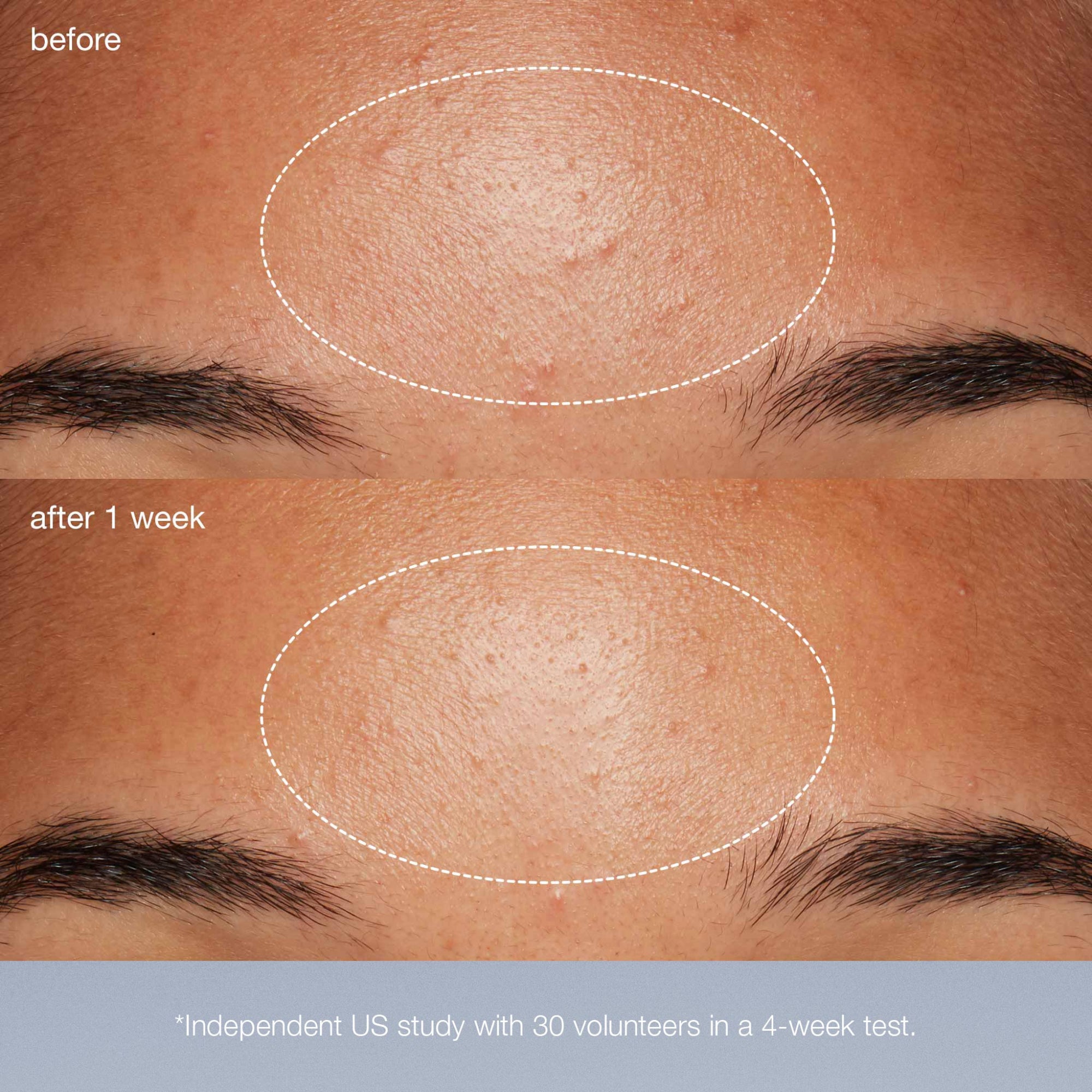 special cleansing gel + daily microfoliant exfoliator