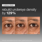 Smart Eye Density