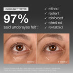 Smart Eye Density