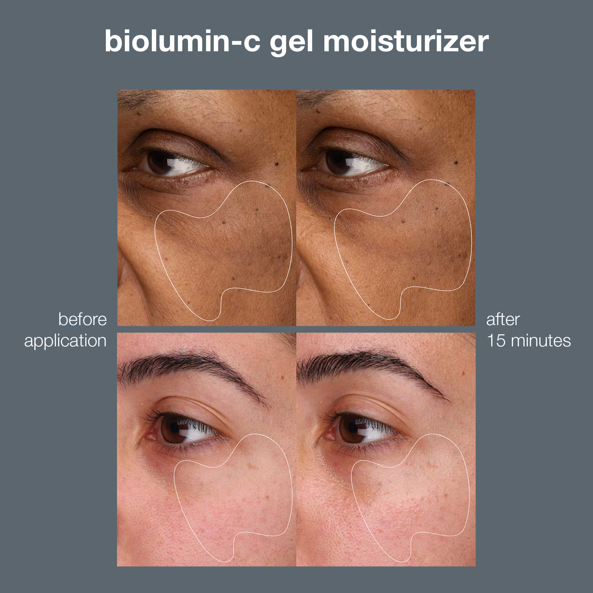 Biolumin-C Vitamin C Gel Moisturiser
