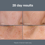 Powerbright Dark Spot System