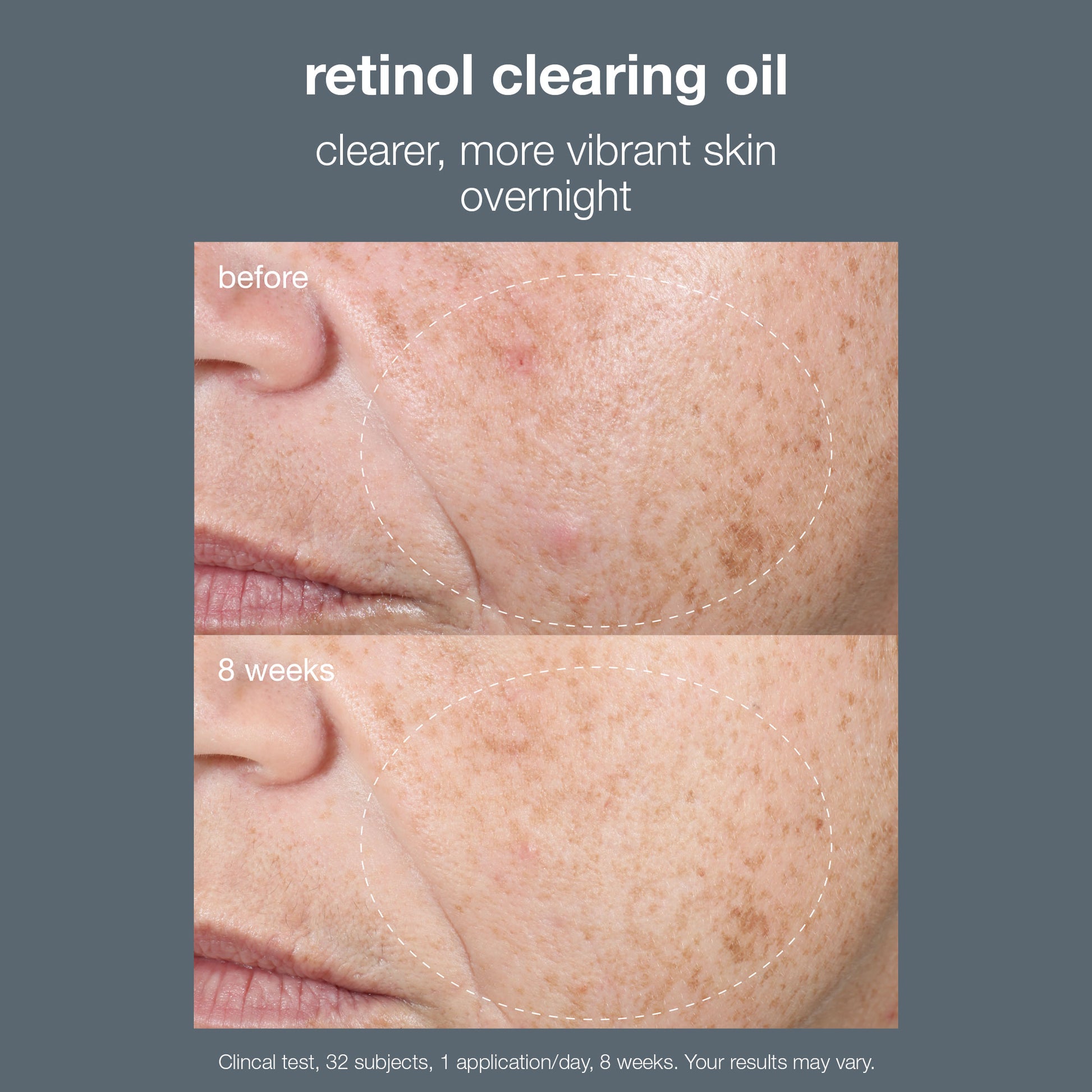 Retinol Clearing Oil Dermalogica IE