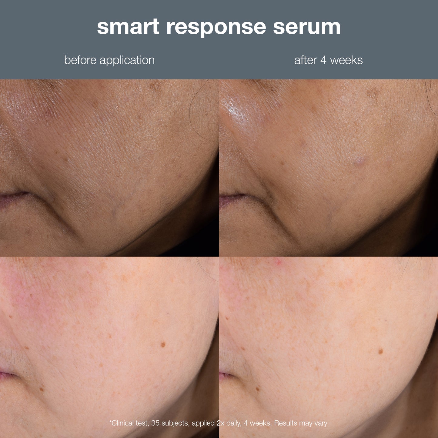 smart response serum