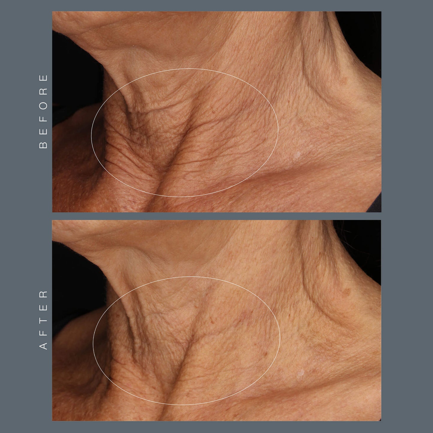 neck fit contour serum